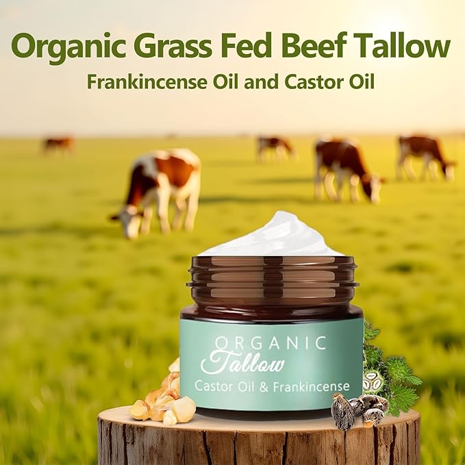 Grass Fed Beef Tallow with Frankincense Oil and Castor Oil, Organic Grass Fed Beef Tallow for Skin, Whipped Beef Tallow Frankincense Oil Castor Oil for Skin Face Body Moisturizer (1)