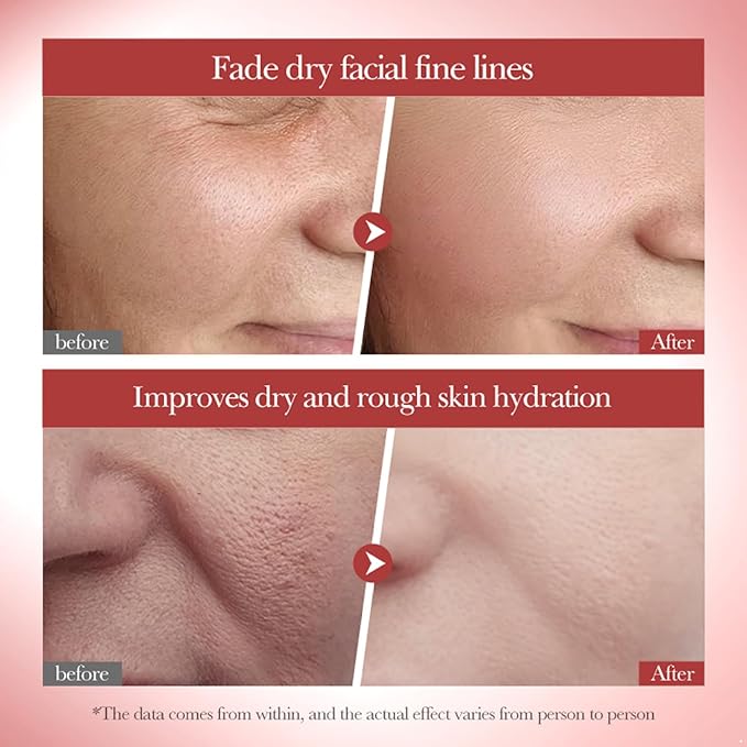 Daily Hydration Boost Facial Spray | Lightweight Toner for a Refreshed Feeling Snail One Size