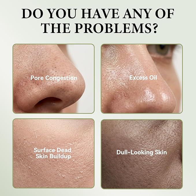 Rice Mochi Face Cleanser, All in One for Face Wash & Mask, Deep Cleansing Moisturizing, Blackhead Remover, Sebum Control, with Rice Water, Green Tea & Walnut Shell Powder, 4.23 OZ