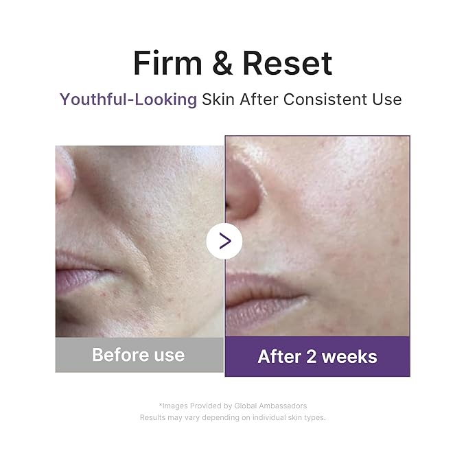 medicube Advanced Refining Serum Duo: Retinol Boosting and PDRN Exosome Shot 2000 | 2000PPM Spicules, Retinol, PDRN, Collagen for firmer, smoother skin | Korean Skincare, Skincare Set, Gifts for Women