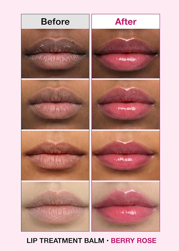 ISOI Bulgarian Rose Lip Treatment Balm (Berry Rose) – Hydrating & Tinted Lip Balm for Dry Lips, Korean Skincare (0.18 oz, 5g)