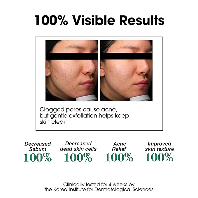 SOME BY MI AHA BHA PHA 30 Days Miracle Toner & Miracle Green Tea Tox Bubble Cleanser
