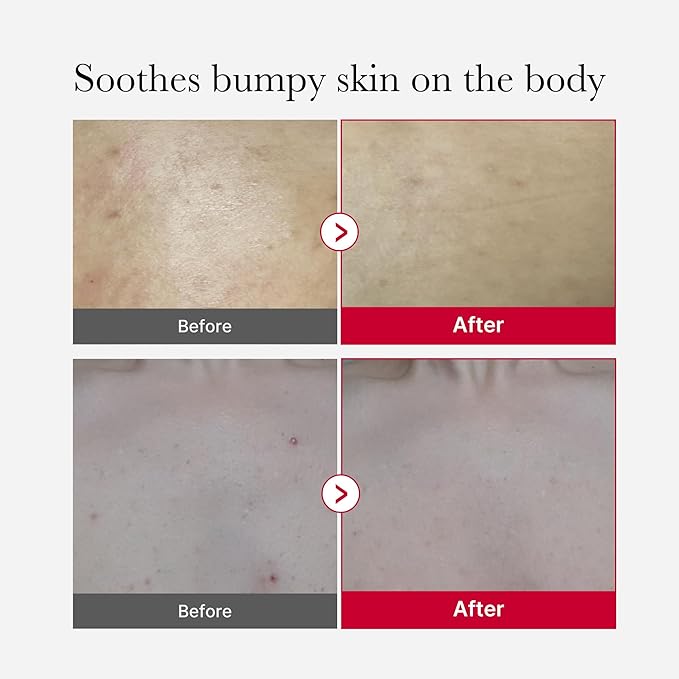 medicube red glow body essentials: Red Body Peeling Shot Body Spray Cleanser and Red Body Wash