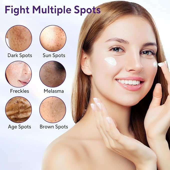 Dark Spot Remover for Face & Body, Advanced Corrector Cream with Niacinamide, Retinol, Arbutin, Hyaluronic Acid & Vitamins B5 C E, Fade Age Spots, Sun Spots, Freckles (1.69 Fl Oz)