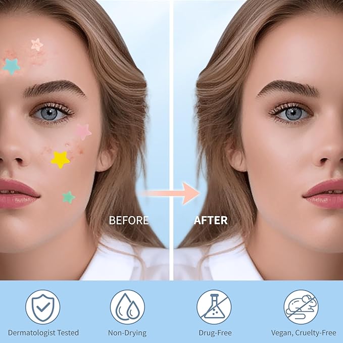 Pimple Patches for Face, Hydrocolloid Acne Patches, Cute Star Zit Covers, Colorful Spot Stickers with Tea Tree, Salicylic Acid & Cica Oil| 3 Sizes (10mm, 12mm & 14mm) |400 Count