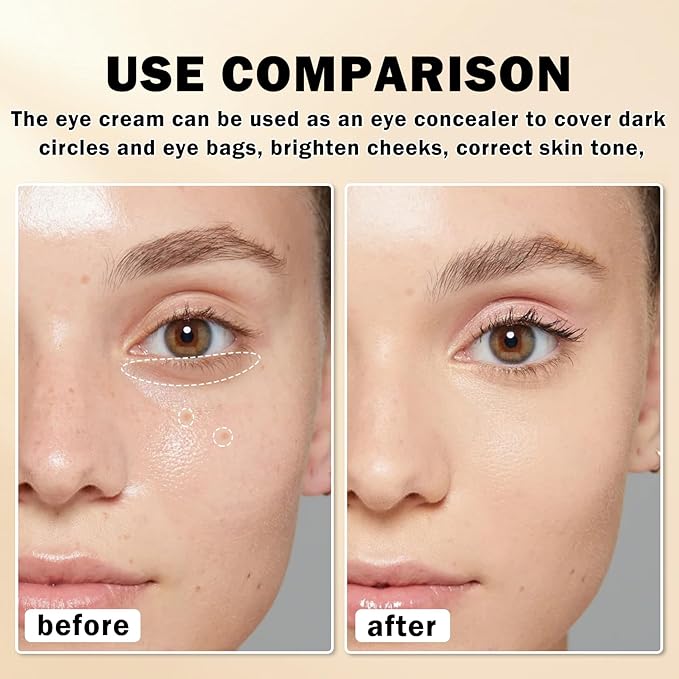 Mineral Sunscreen Eye Cream,3-in-1 Under Eye Cream,for Puffiness and Bags Under Eyes,Dark Circle and Wrinkles,Anti Aging,Under Eye Brightener and Concealer,SPF 35 （Light）