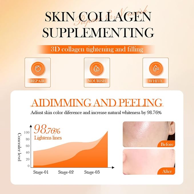 5X Vitamin C & Niacinamide Moisturizer with Hyaluronic Acid - Brightening & Glow Cream for Dark Spots, Hydrating Face Cream 50g, TikTok Favorite Gift for Women