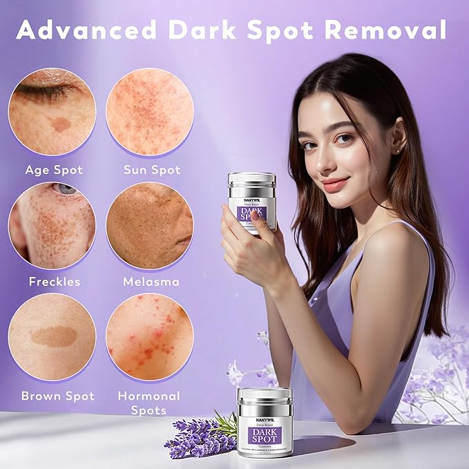 HANYWIL Dark Spot Remover for Face & Body, Remedy for Dark Spots with Natural Ingredients, Dark Spot Corrector Cream and Serum for Skin Care, Treats Freckles, Melasma, Sun Spots, Women & Men,1.7 Fl Oz