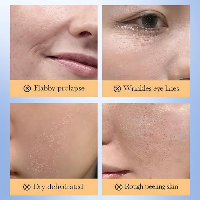 Collagen Skin Care Set, 6-Piece Anti-Aging Kit for Women to Help Reduce Fine Lines & Wrinkles, Hydrating & Pore-Minimizing, Includes Serum, Cream, Eye Cream, Toner, Cleanser, Daily Routine & Gift Set