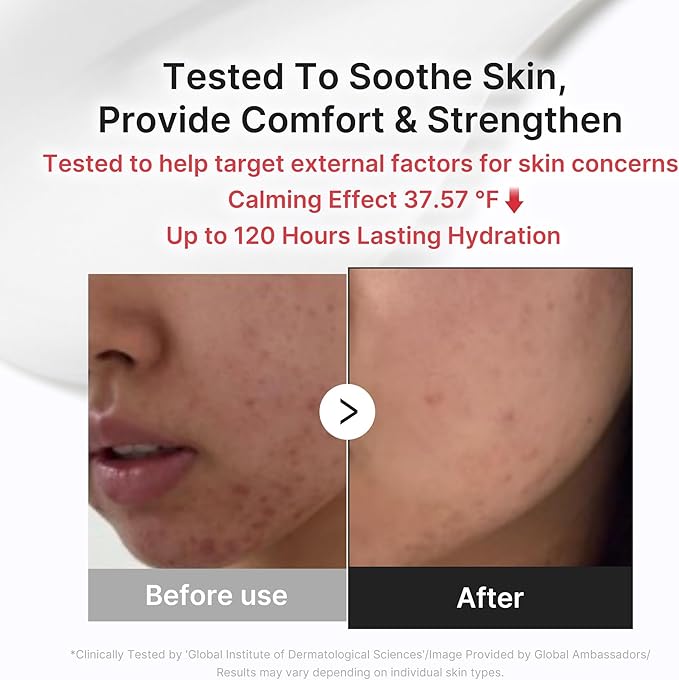 medicube Clarifying Pad & Soothing Cream Duo: Red Succinic Acid Pad and 3H Daily Daily Moisturizer | Gentle Exfoliation for Clearer, Radiant Skin | Balance & Comfort Care Routine