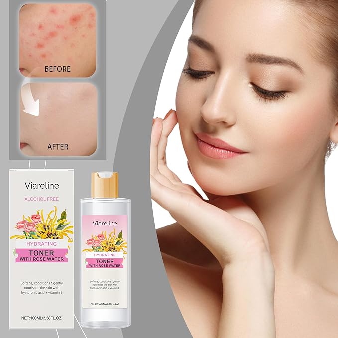 Hydrating Rose Water Toner with Hyaluronic Acid, Alcohol-Free Facial Mist for Daily Moisturizing, 3.38 Fl Oz