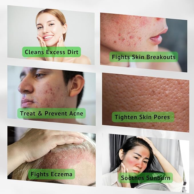 Aloe Vera Toner for Face. Skincare to Treat and Prevent Acne, Restore PH Balance & Excess Dirt. Facial Toner for Women and Men.
