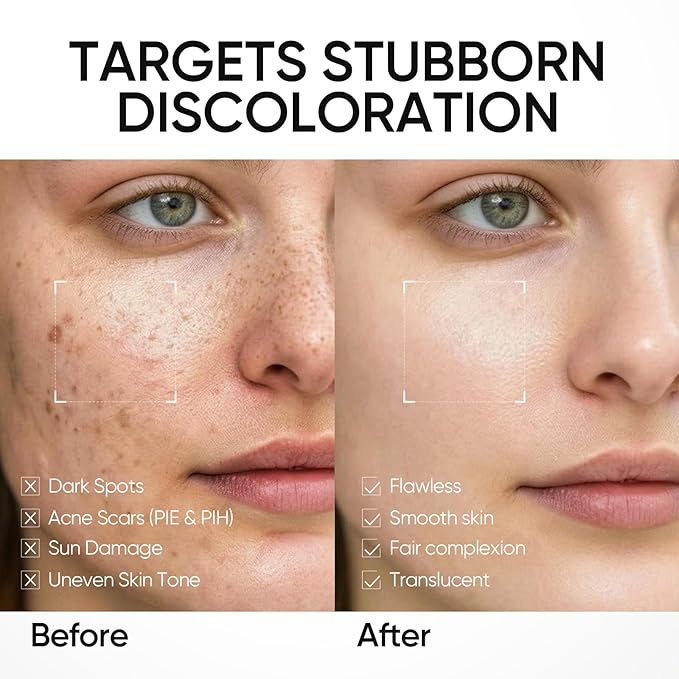 Dark Spot Moisture Cream, Brightening Moisturizer, Fades Dark Spots, Hyperpigmentation, 5X Ceramide Barrier Repair, 24H Hydration, Non-Greasy, 3.53 Fl Oz (Pack of 1)