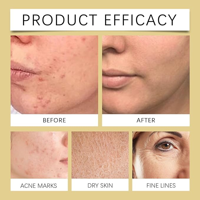 Hydrating Toner Spray - Moisturizing & Brightening Face Toner, Reduces Fine Lines, All-Day Skin Hydration & Refreshment(2PCS)