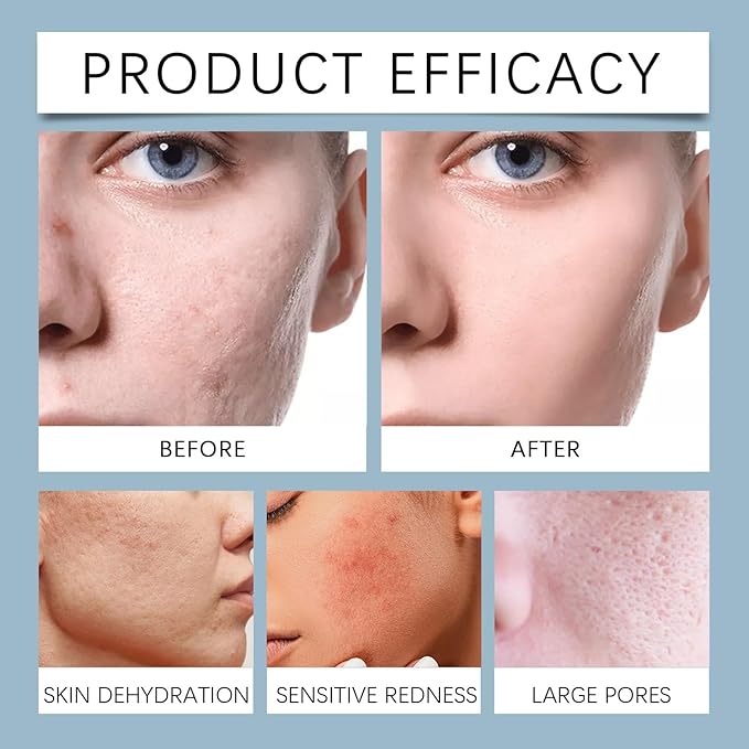 Facial Toner For Skin Care - Long-Lasting Hydration, Brightens Skin, Easy Absorption No Greasy Residue(2PCS)