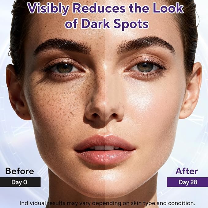 Dark Spot Remover for Face & Body, Advanced Corrector Cream with Niacinamide, Retinol, Arbutin, Hyaluronic Acid & Vitamins B5 C E, Fade Age Spots, Sun Spots, Freckles (1.69 Fl Oz)