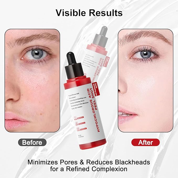 Gentle Exfoliating Serum with Hypochlorous Acid & Rice Extract - Daily Peel Solution for Smooth & Radiant Skin - 80ml