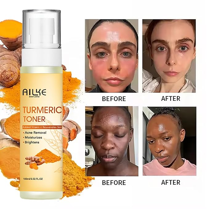 AILKE Natural Turmeric Face Toner, Brightening, Hydrating, Rejuvenate Skin, Acne & Pimples Removal, Clean Skin With Vitamin C, For All Skin Types, 3.52 fl oz (Pack of 1)