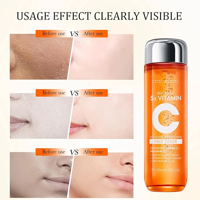 5X Vitamin C & Hyaluronic Acid Hydrating Toner - Brightening, Pore Minimizing Facial Toner for Glowing Skin & Sensitive Skin, 130ml（Gift for Women）