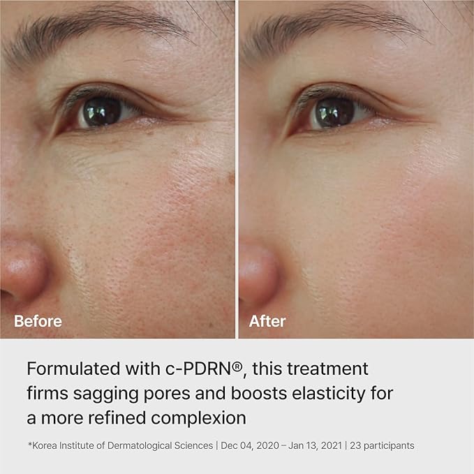 REJURAN® Ampoule Infused Lifting Mask, DOT™ c-PDRN® – Firming & Pore-Tightening Hydrogel Sheet with Waterfalling Complex for Radiant, Elastic-Looking Skin, Korean Skin Care (28g x 4ea)