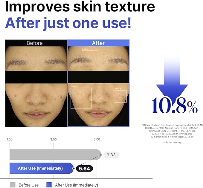 Real Blue Centella Azulene Toner | Calming & Hydrating Facial Toner for Oliy & Sensitive Skin with Azulene, Centella | Korean Skin Care (300 ml/10.14 fl.oz.)