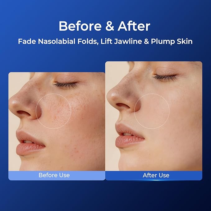 Hydrating Facial Toner for Smooth & Firm Skin, Deeply Moisturizes & Plumps, Improves Skin Elasticity & Jawline Definition