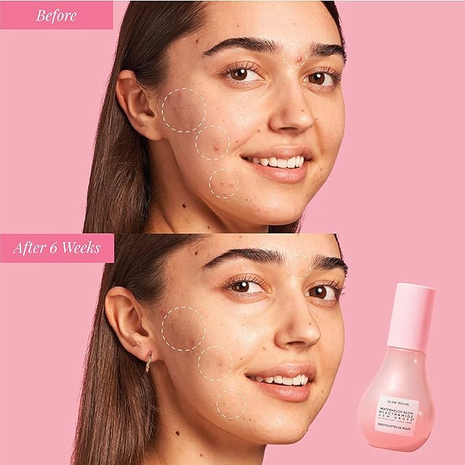 Glow Recipe Watermelon Niacinamide Dew Drops, Korean Niacinamide Serum Drops, Hydrating Face Serum + Primer & Liquid Highlighter, Hyaluronic Acid, Dewy Glow (40ml)