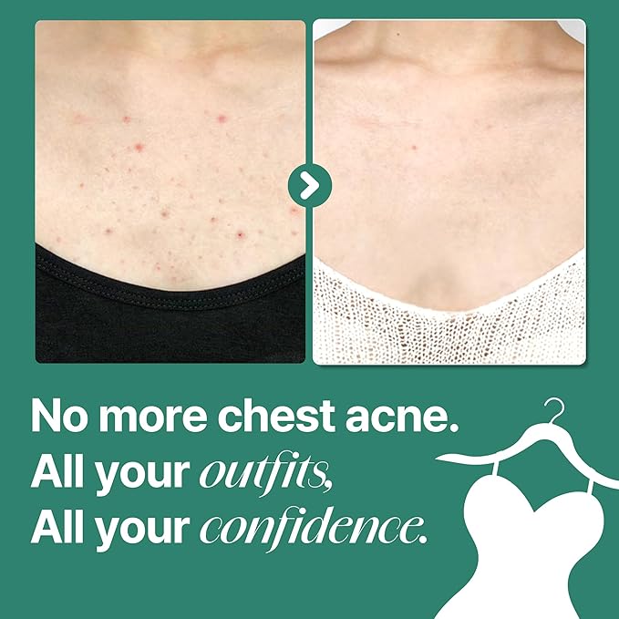 SOME BY MI AHA BHA PHA 30 Days Miracle Toner & Miracle Acne Clear Body Cleanser