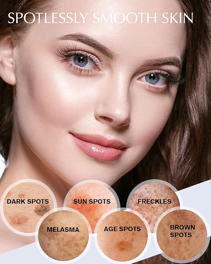 Dark Spot Remover for Face and Body: Hyperpigmentation Treatment - Natural Ingredient - Freckle/Melasma/Sun Spot/Age Spot Remover - Dark Spot Corrector Cream for Women and Men