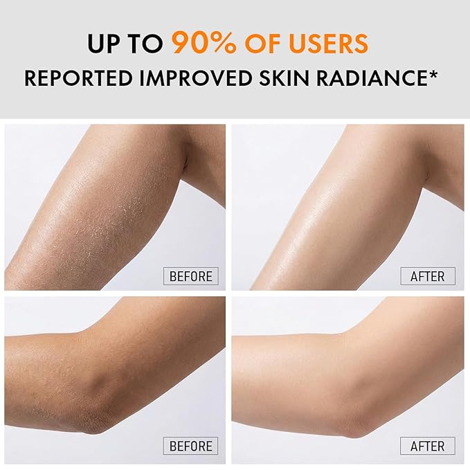 Kojic Acid & Turmeric Body Care Spray, Gentle Exfoliating Texture Care with Soft Sponge Applicator, Daily Body Skin Care for All Skin Types, 200ml