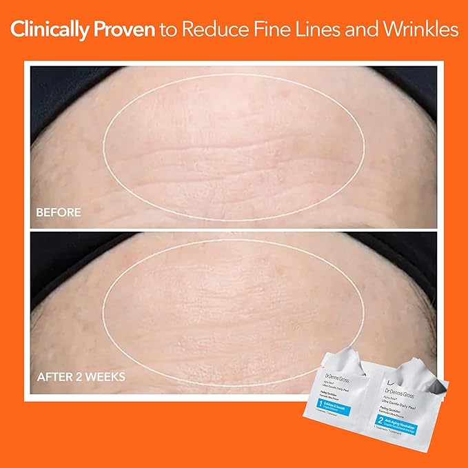 Dr. Dennis Gross Alpha Beta Ultra Gentle Daily Peel: for Dehydrated or Sensitive Skin, Uneven Tone or Texture, Fine Lines or Enlarged Pores (30 Treatments)