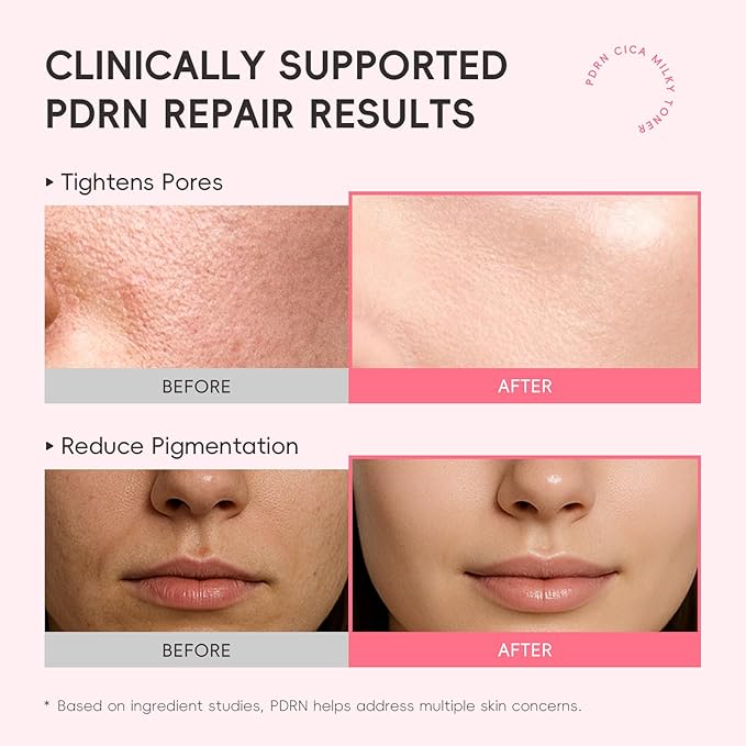 PDRN CICA Milky Toner, 5000ppm Salmon PDRN & Centella Hydrating Toner for Face with Niacinamide & Hyaluronic Acid, Support Skin Barrier & Boost Radiance, Suitable for All Skin Types (Pack of 1)