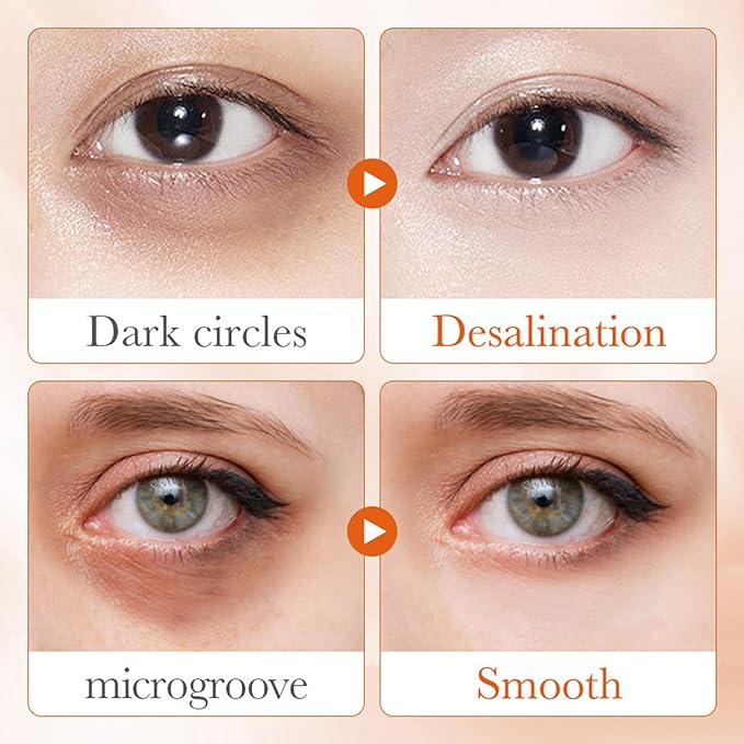 5X Vitamin C Eye Cream with Niacinamide - Firming & Brightening Eye Treatment for Dark Circles, Wrinkles & Puffiness | Nourishing Moisturizer 20g, Gift for Women