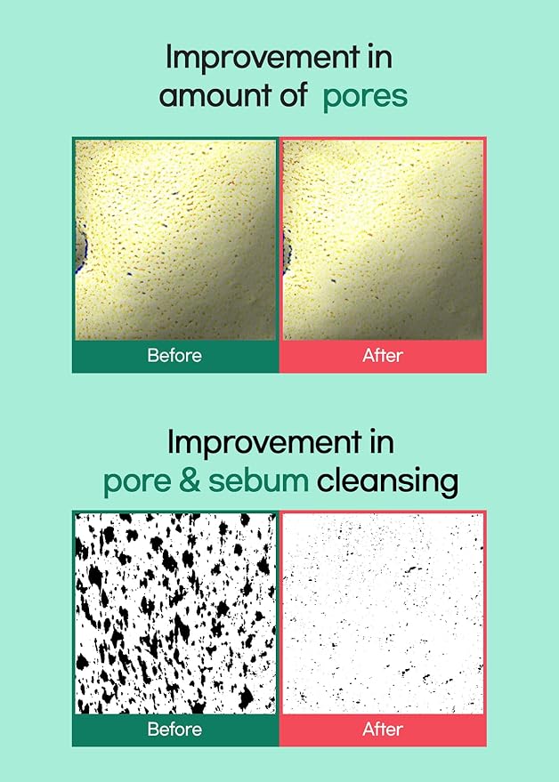 BRING GREEN Tea Tree Cica Pore Clay Pack | Vegan Deep Pore Cleansing Clay Mask, for Pore Purifying, Contains Cica & Tea tree for Soothing & Relieving Stressed Skin 4.23 oz.