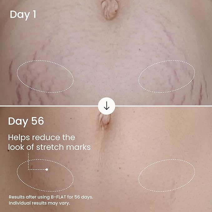 MAËLYS B-FLAT Belly Firming Cream for Women - Skin Tightening & Moisturizing Treatment with Shea Butter & Bentonite Clay - Smooths Look of Stretch Marks - Postpartum Body Care (3 Pack)