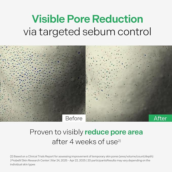 Torriden BALANCEFUL Control Serum 50ml (1.69 fl.oz.) | Daily Sebum & Oil Control for Sensitive Skin | 5D Complex Cica, 4% Niacinamide | Korean Facial Serum