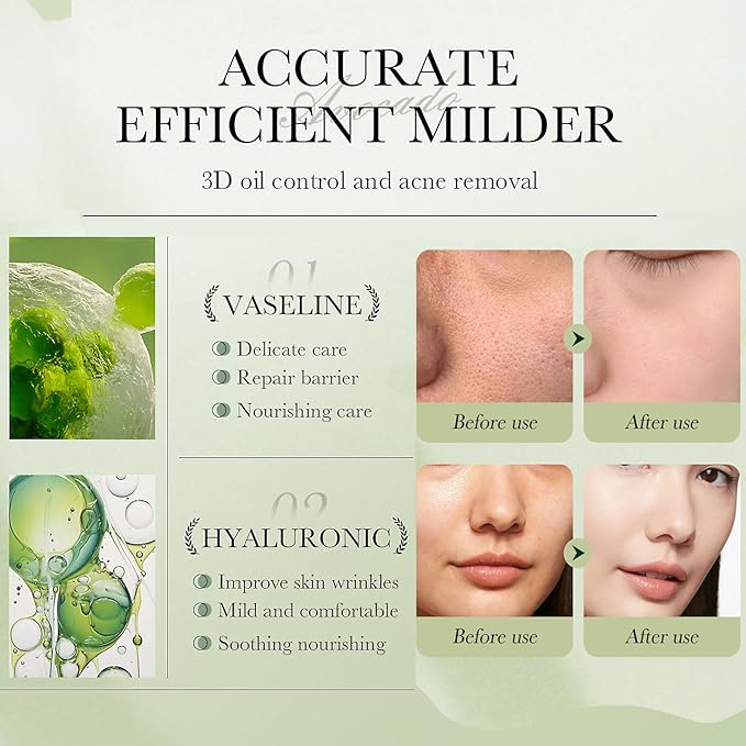 Avocado Skin Care Set for Women, 6-In-1 Skincare Gift Set With Facial Cleanser, Face Serum, Face Cream, Eye Cream, Toner, moisturizing lotion. Skin Care Sets & Kits, Hydrating Facial Kit