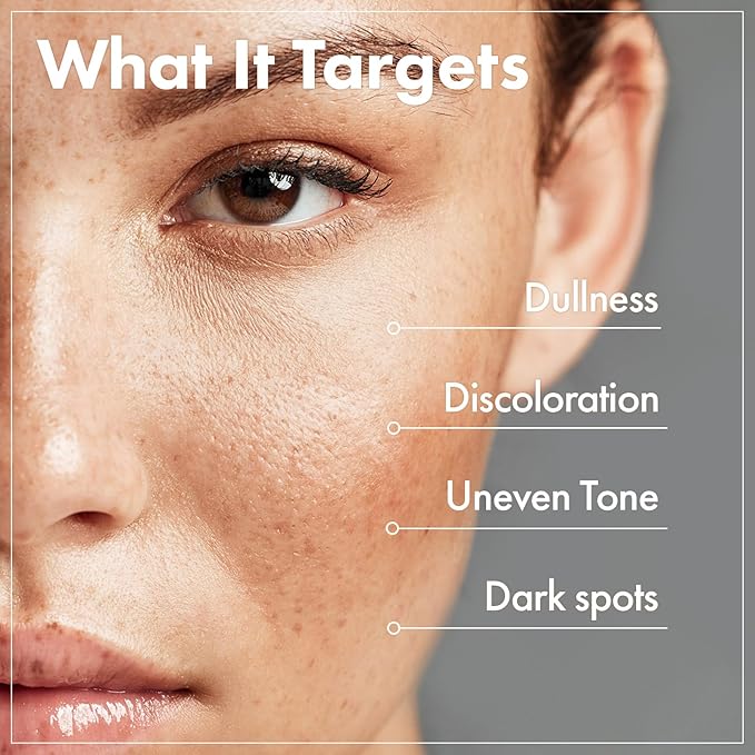 TOSOWOONG Radiance & Clarity Duo: Arbutin 7% Glutathione Cream & Rice Glow Milky Toner for Clearer, Luminous Skin