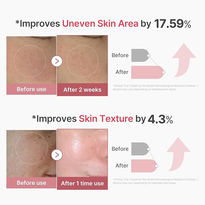 medicube Advanced Refining Serum Duo: Retinol Boosting and PDRN Exosome Shot 2000 | 2000PPM Spicules, Retinol, PDRN, Collagen for firmer, smoother skin | Korean Skincare, Skincare Set, Gifts for Women