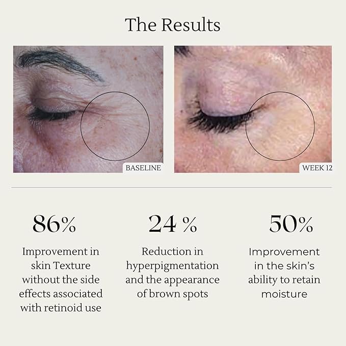 Sonrei Clearly Zinq Hydrating Tinted Facial SPF 35 + Anti-aging Growth Factor Sunscreen Mineral Gel & Primer | Broad Spectrum UV Protection | Water Resistant, Vegan | Non-greasy - 1.7 Fl oz.