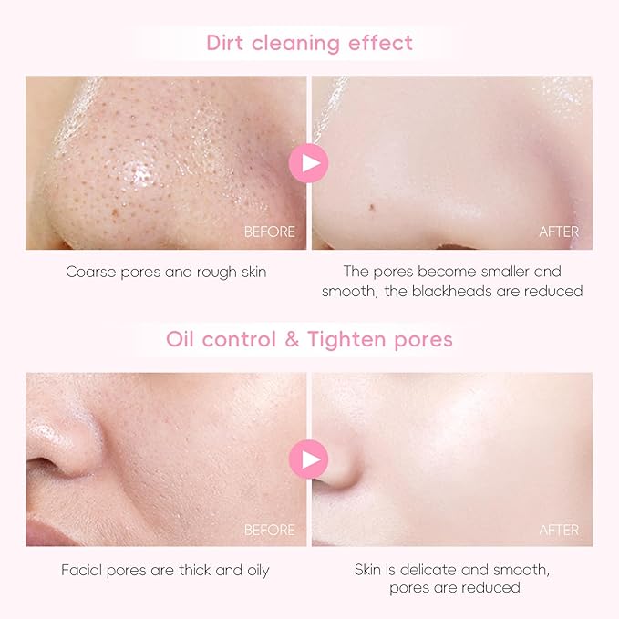 Skin Care Set, Gift Sets Skin Care Kit for Teenage Girls - JAPAN Cherry Blossom Skincare Sets Cleanser, Toner, Serum, Face Cream, Travel Kit for Women Kids Teenagers(15pcs)