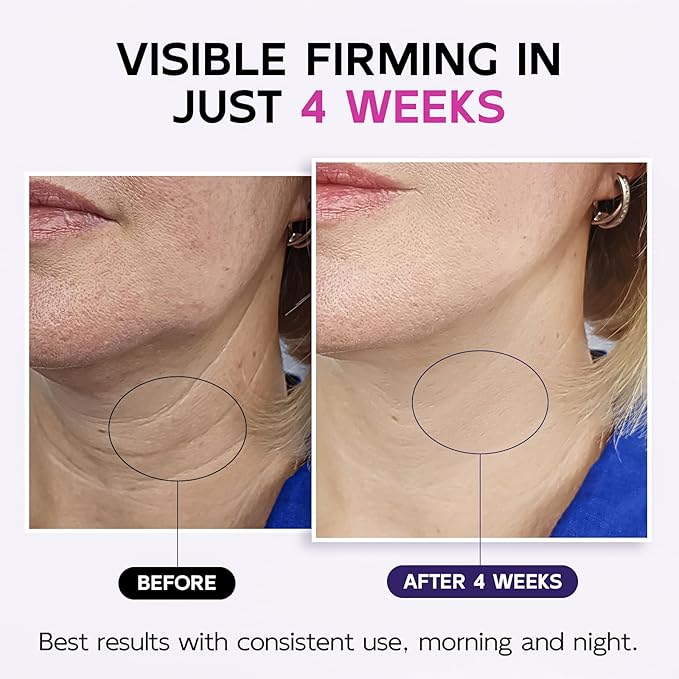 Neck Firming Cream with Roller, Tighten & Lift Neck & Chest Moisturizing Cream, Anti-Aging, Smooths Wrinkles & Crepey Skin, Visibly Firming, Multi-Peptide, Retinol, Collagen, Hyaluronic Acid 4.3 Fl Oz