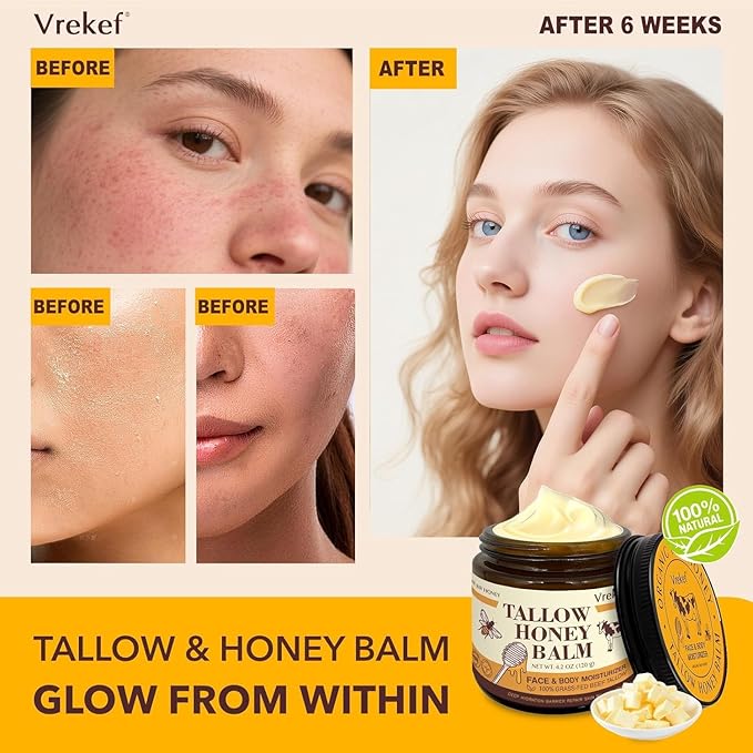 Beef Tallow for Skin (4.2 oz)– Tallow and Honey Balm for Face & Body – Grass-Fed Tallow with Beeswax, Sea Buckthorn Oil, Shea Butter, Vitamin E – Natural Moisturizer