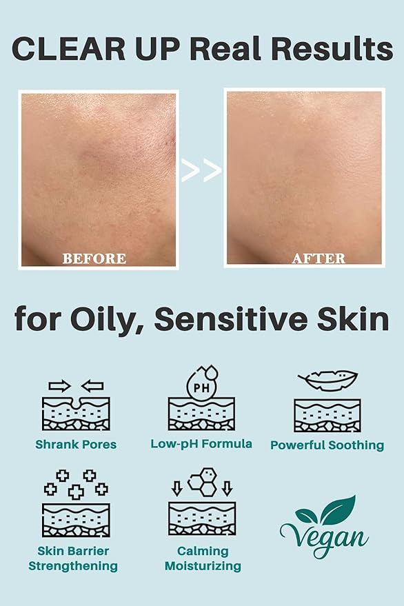 Tea Tree CICA 80 Toner – K-Beauty Calming & Exfoliating Face Toner for Sensitive, Oily Skin | Daily Skin Prep with 80% Tea Tree Water | Pore & Sebum Control