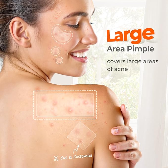 TKTK Large Pimple Patches for Face, 68 x 27 mm XL Hydrocolloid Bandages, Big Acne Patches for Body, Forehead, Chin, Nose, Chest and Back Blemish Zit Breakouts (Strip, Contoured, Dot 5 Sizes 295 Count)