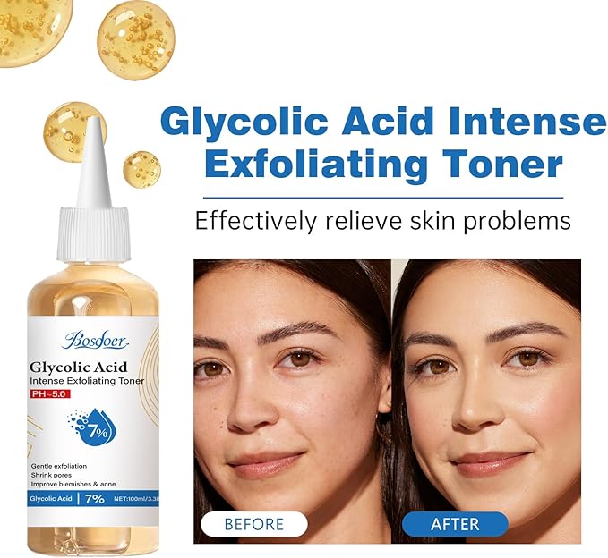 7% Glycolic Exfoliating Acid Toner, Even Skin Tone, Smooth Skin, Unclogs Pores, Gentle Effective Toner with Hydrating Properties for Daily Use