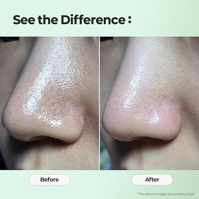 MOTHER MADE Green Tea-Rouble Away Clarifying Toner with AHA BHA PHA 150 ml