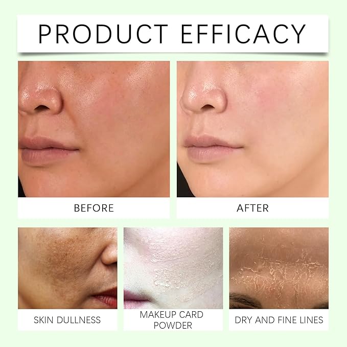 Face Tightening Toner - Deep Hydration, Firming & Brightening Essence, Moisturizing Facial Skincare For Dry/Environmental Skin Issues(2PCS)