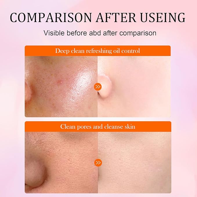 5X Vitamin C Face Cleanser 100g with Niacinamide & Hyaluronic Acid - Gentle Pore Refining Daily Wash for Oily, Dull Skin | Oil Balancing, Radiant Hydrated Complexion, Gift for Women