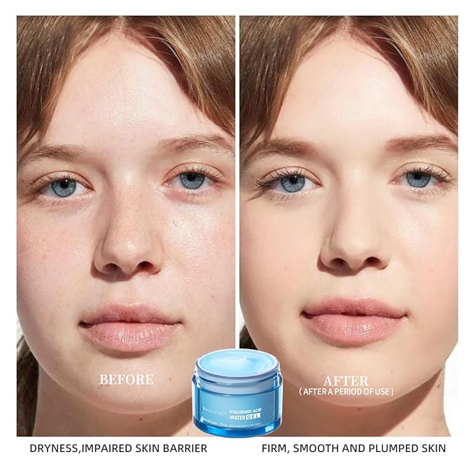 Hydro Boost Hyaluronic Acid Water Gel,Face Moisturizer For Oil Skin,Hyaluronic Acid Formula Combines With Water for Long-lasting Moisturization and Plumped Up Skin-1.76Oz (Water Gel)